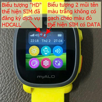 SIM lắp vào đồng hồ đã đăng ký dịch vụ HDCALL và dịch vụ DATA